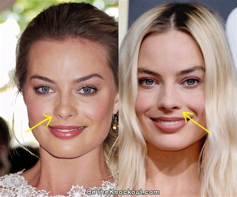 margot robbie before and after surgery|Margot Robbie, Before and After